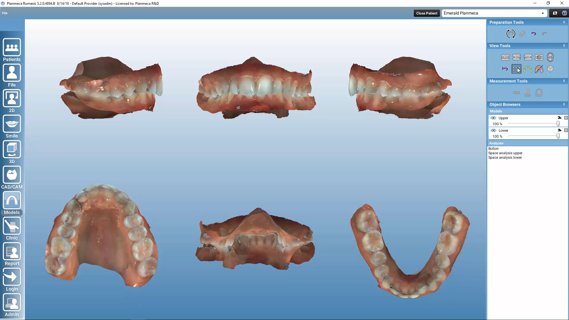 Romexis® Model Analyser