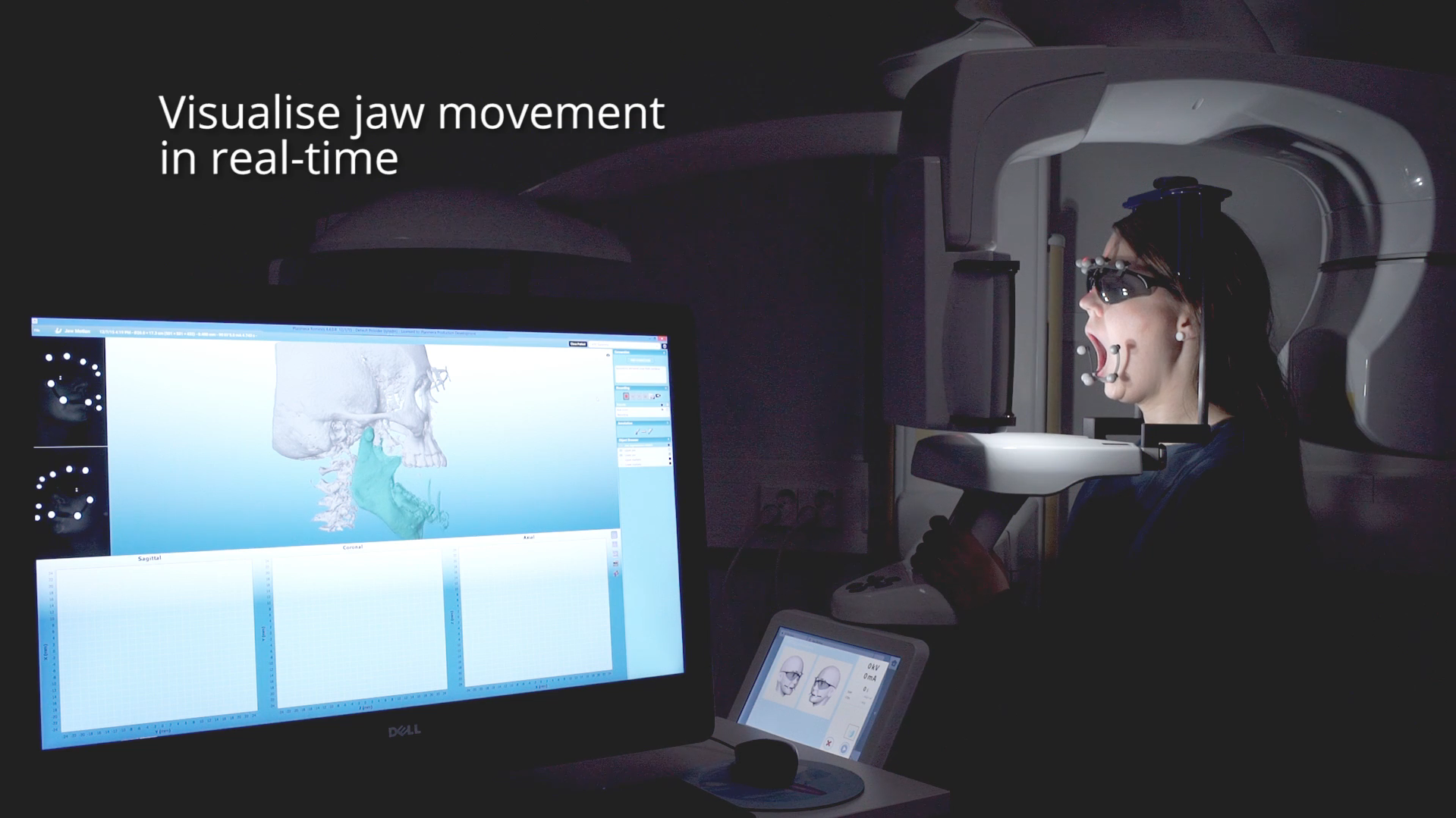 Planmeca 4D™ Jaw Motion