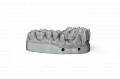 CAD/CAM полимеры - смолы