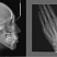 Рентген Planmeca ProMax 3D Mid