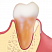 OsteoBiol® Evolution