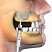 OsteoBiol® Gel 40