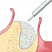 OsteoBiol® GTO
