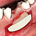 OsteoBiol® Evolution