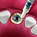 OsteoBiol® Putty