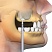 OsteoBiol® Gen-Os