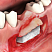 OsteoBiol®  Sp-Block