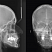 Рентген Planmeca ProMax 3D Mid