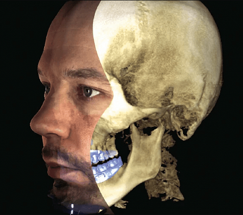 Рентген Planmeca ProMax 3D s