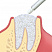 OsteoBiol® GTO